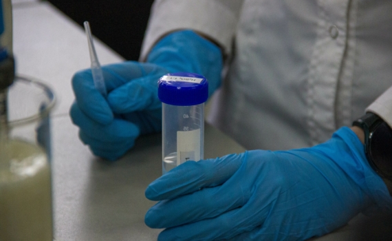 Нипах vs COVID: отличия, последствия. Новый вирус начинается с боли в горле – 75% летальность, кома Нипах vs COVID: отличия, последствия. Новый вирус начинается с боли в горле – 75% летальность, кома